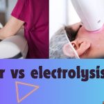 Laser vs Electrolysis